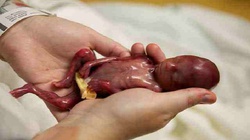 Niesamowita historia: Nasz 19-tygodniowy syn żył tylko kilka minut po urodzeniu, ale poruszył tysiące istnień - miniaturka