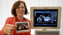 Położnik: Ciąża z in vitro 65-latki to szaleństwo - miniaturka